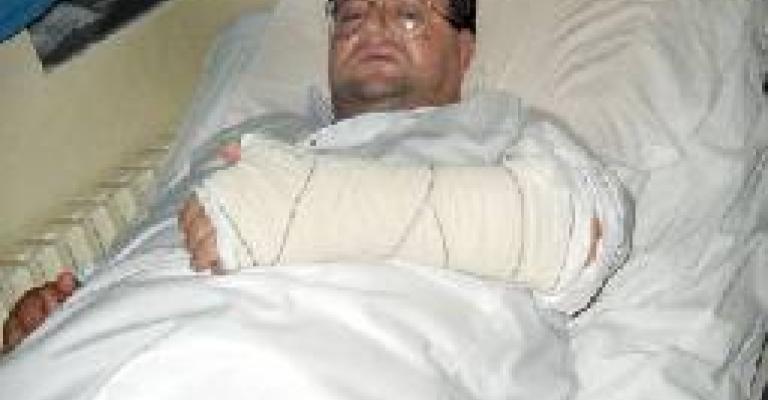 نائب سابق يتعرض للضرب يإربد والشرطة تلقي القبض على الفاعلين