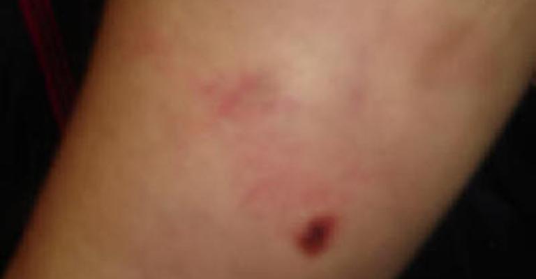 ‘Najwa’ victim of torture on Woman’s Day ‘Najwa’ victim of torture on Woman’s Day