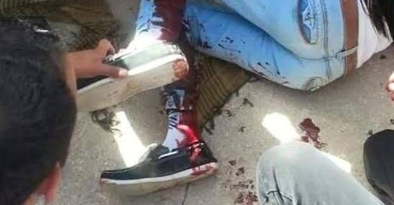 تجمهر في آل البيت بعد إصابة طالب بعيارات نارية