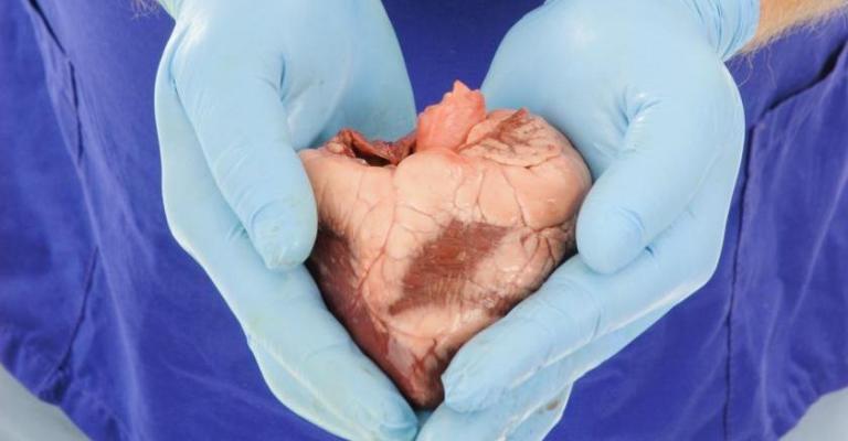 التبرع بالأعضاء.. "ومن أحياها فكأنما أحيا الناس جميعا" التبرع بالأعضاء.. "ومن أحياها فكأنما أحيا الناس جميعا"