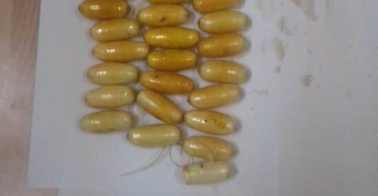 القبض على شخصين ابتلعا كبسولات محشوة بالكوكائين