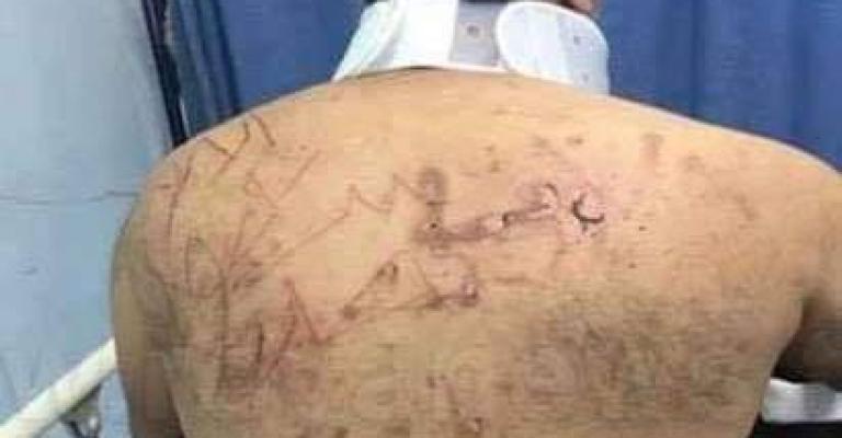 المدعي العام يسند (4) تهم ليونس قنديل