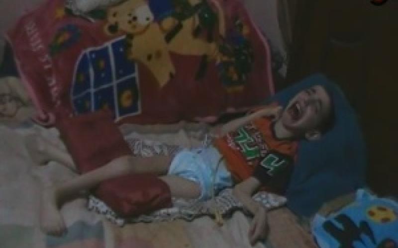 مرض غريب يفتك بثلاثة أطفال في الزرقاء "فيديو"