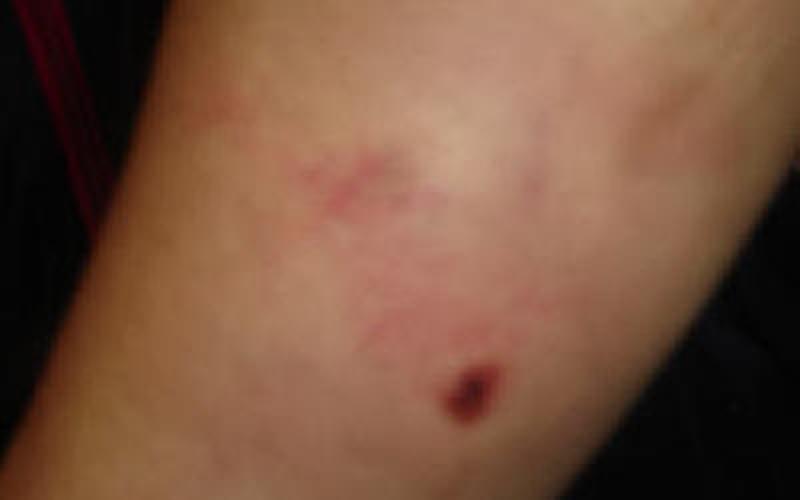 ‘Najwa’ victim of torture on Woman’s Day