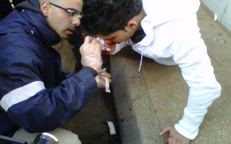 Jordanian journalists: Friday’s attack is a black spot in the government’s record