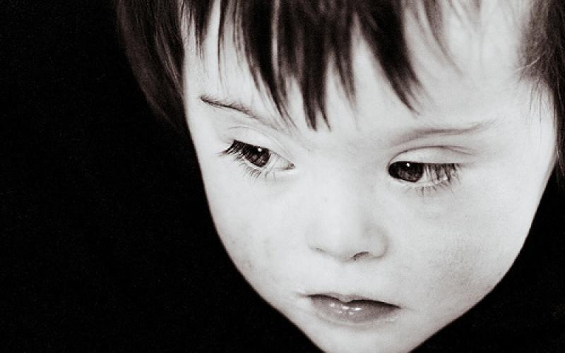 Mothers of children with Down Syndrome...hardships beyond expertise