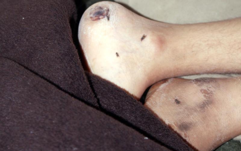 مرض خوله يحطم أحلام عائلتها