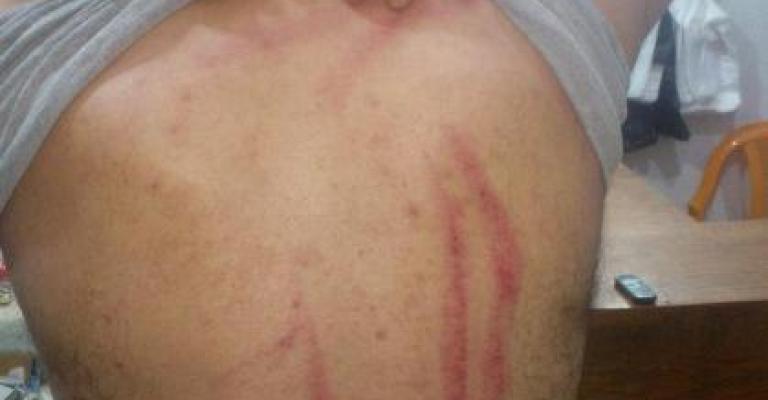 ناشط يُجابه بقنابل غاز والأمن يؤكد حق الاستخدام ناشط يُجابه بقنابل غاز والأمن يؤكد حق الاستخدام