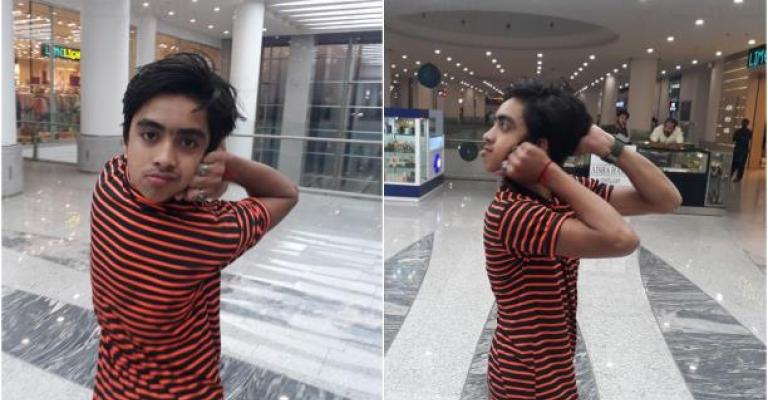 فتى يستطيع تدوير رأسه 180 درجة