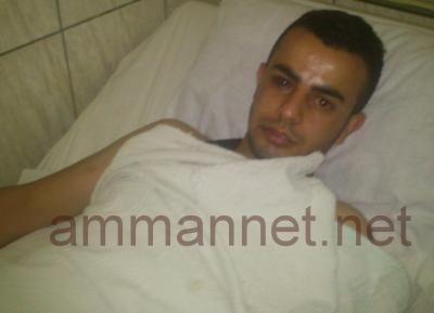 صور- الامن يعتدي على شاب في اربد صور- الامن يعتدي على شاب في اربد