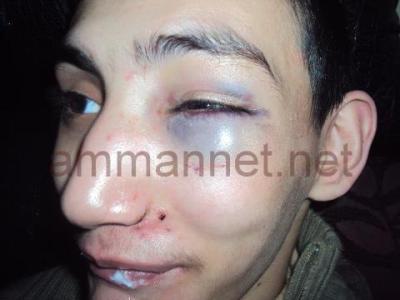 عام على زيارة الملك لمراكز المعاقين .. الانتهاكات مستمرة! عام على زيارة الملك لمراكز المعاقين .. الانتهاكات مستمرة!