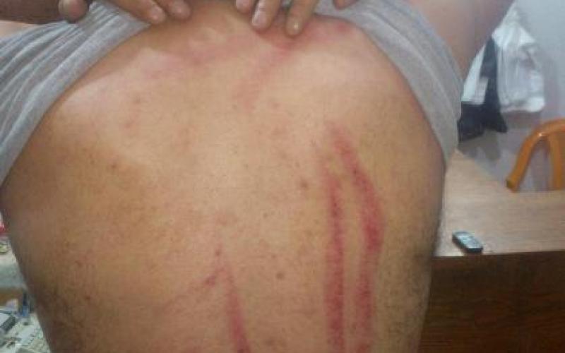 ناشط يُجابه بقنابل غاز والأمن يؤكد حق الاستخدام 