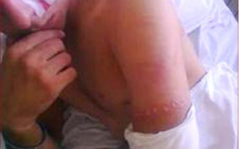 قضية ليث: الحكومة تتحقق والأمن يبرر ومنظمات مصدومة