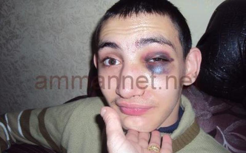 عام على زيارة الملك لمراكز المعاقين .. الانتهاكات مستمرة!