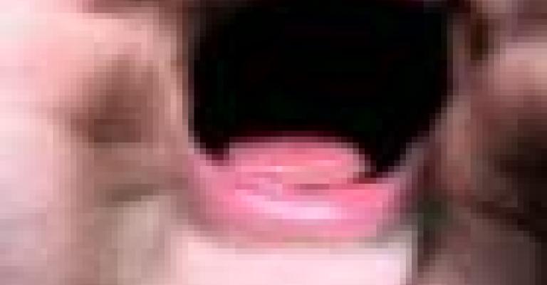 اكزوزت الصوت الواحد