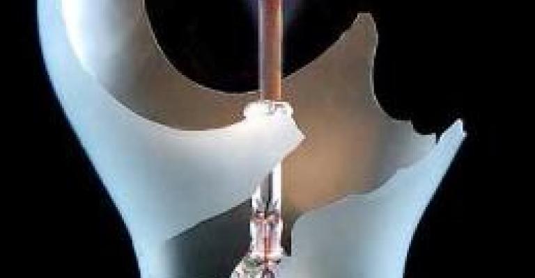 توليد الكهرباء تفصل مئات الموظفين