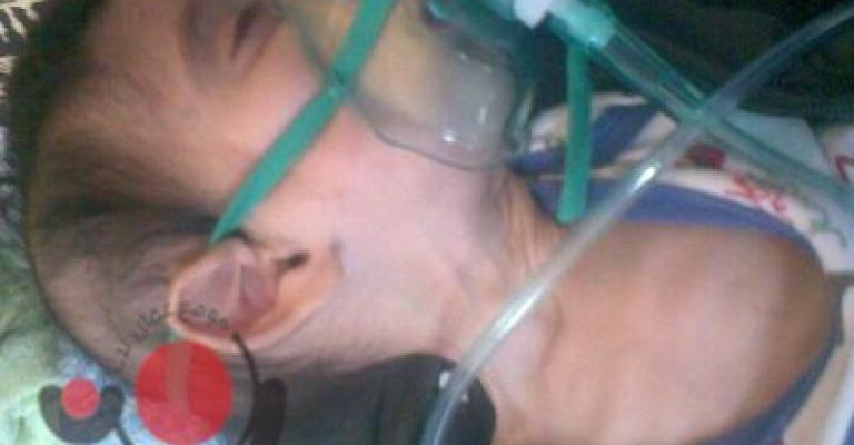 صور.. ضمور دماغ الطفل محمد نتيجة لنقص الاختصاصات الطبية 