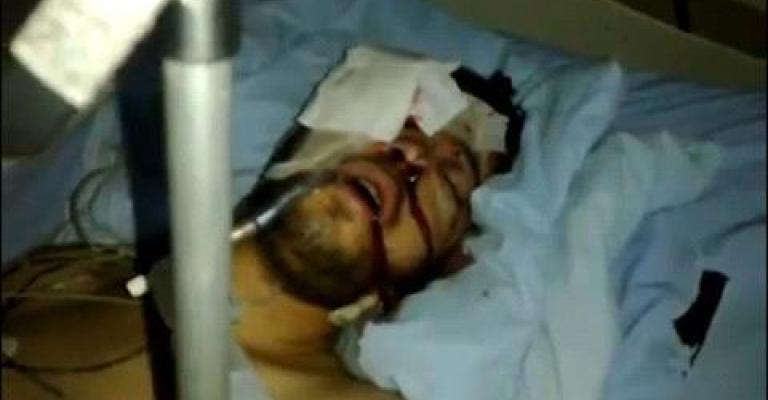 المصاب الخالدي في مستشفى المؤسس وحالته الصحية حرجة جدا (صوت) المصاب الخالدي في مستشفى المؤسس وحالته الصحية حرجة جدا (صوت)