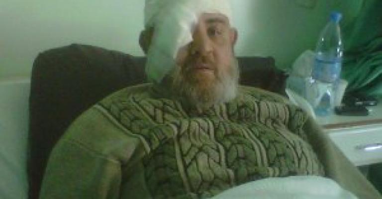 فيديو.. صالح يفقد بصره والخوالدة يعاني كسرا في الجمجمة