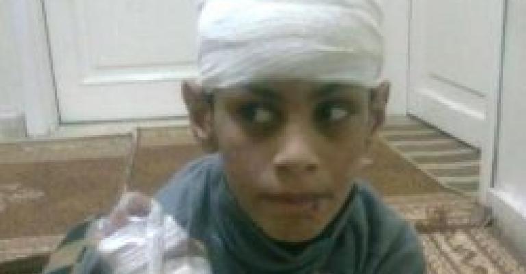 عزايزة لـراديو البلد: سحب ممثلي الوزارة من لجنة التحقيق لضمان الحيادية وللتحقيق مع كافة الأطراف