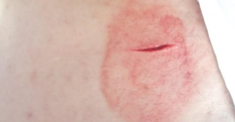 الاعتداء على مسيرتي جرش والمفرق عمل خسيس 