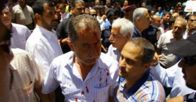  الوطنية للإصلاح لماذا تعجز الحكومة عن حماية الحراك ؟