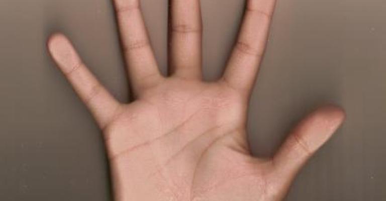 إصابة عامل وافد ببتر في الأصابع إصابة عامل وافد ببتر في الأصابع