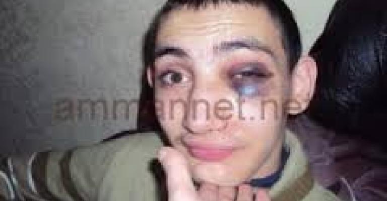 اغلاق 7 مراكز لرعاية المعوقين وانذار 16 مركزا