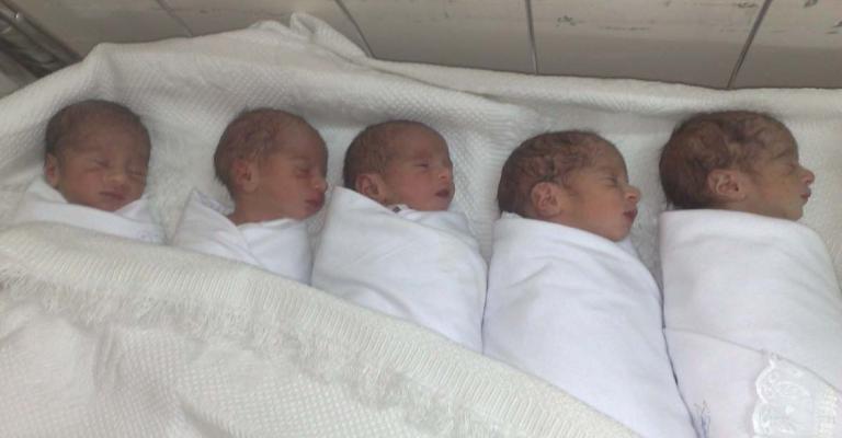  أردنية تنجب خمسة توائم 
