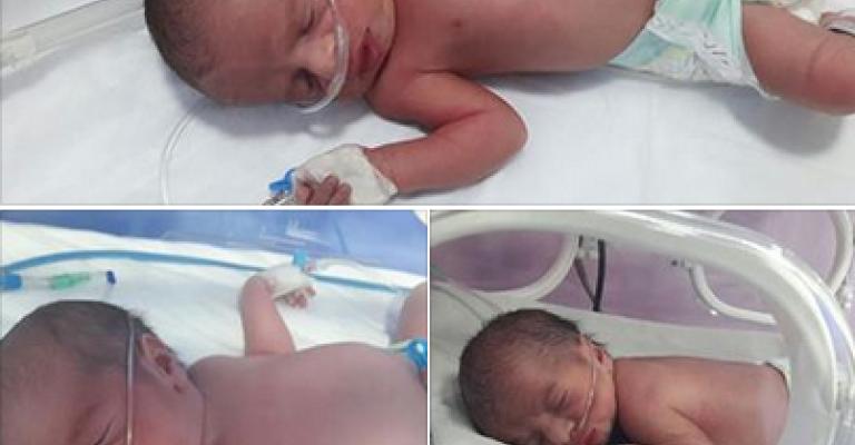 عملية ولادة نادرة لـ 3 توائم بـ"قيصرية" في مستشفى المقاصد (صور)‎