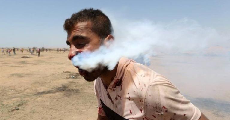 الجريح هيثم  أبو سيلة من غزة يصل الأردن للعلاج