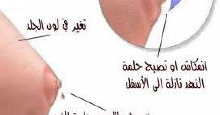 زيادة إصابة سرطان الثدي ونساء لا يجدن وقتا للفحص