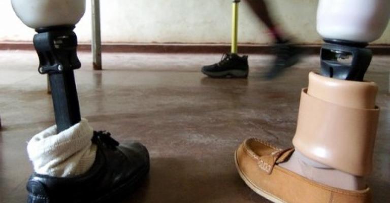 أطراف اصطناعية وإرادة لمواصلة الحياة