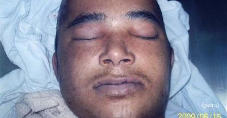 توفي منذ ايام ولم يسأل عنه احد