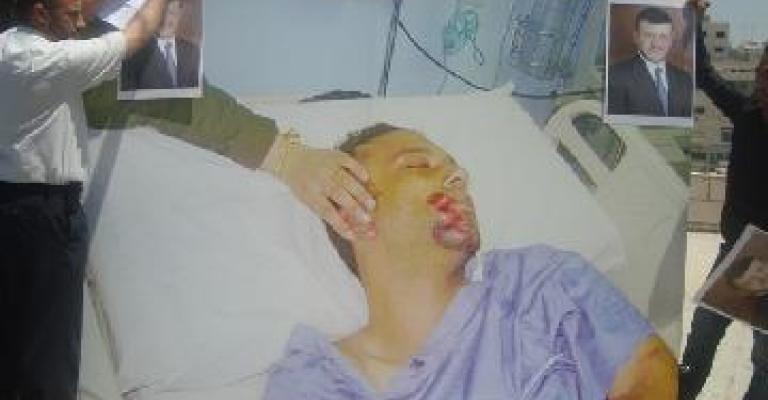 العامل العلاونة يستيقظ من الغيبوية..و وزير الداخلية يطمئن عليه