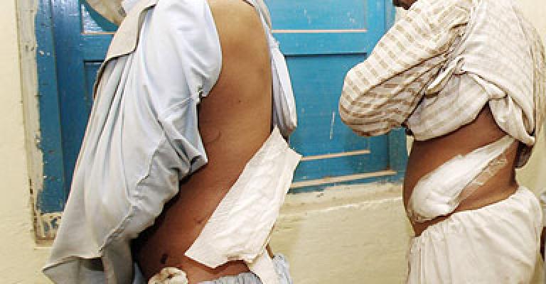 توقيف سمسار كلى وشابين تبرعا بكلاهم مقابل المال