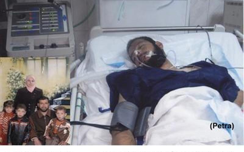 عامل بشركة كيماويات يدخل الموت السريري إثر استنشاق غازات سامة