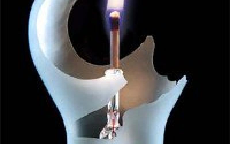 المتقشّفون الجدد