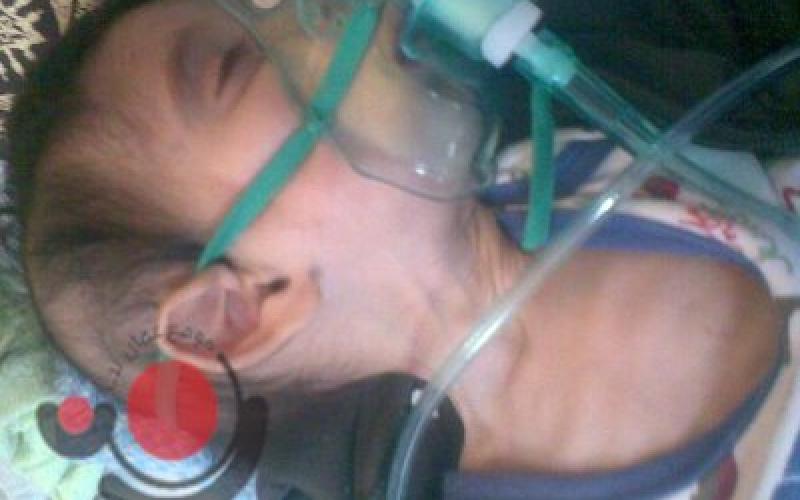 صور.. ضمور دماغ الطفل محمد نتيجة لنقص الاختصاصات الطبية 