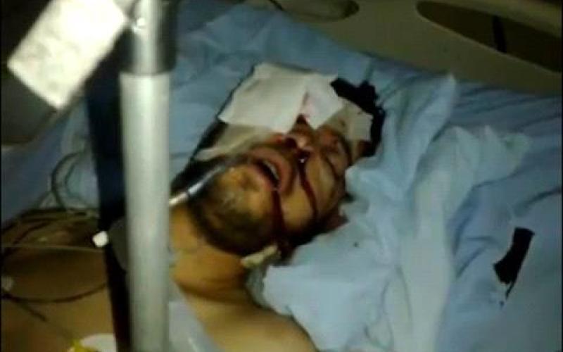 المصاب الخالدي في مستشفى المؤسس وحالته الصحية حرجة جدا (صوت)