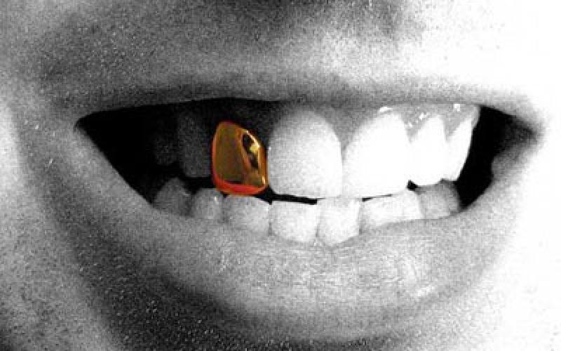 "الضروس" المستفادة