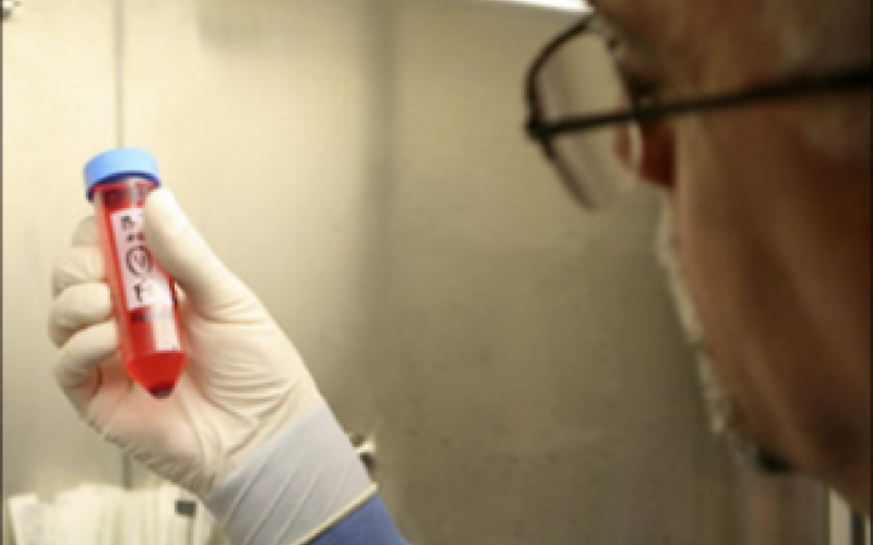 أمراض فايروسية تثير حالة فزع بين المواطنين وتطمينات من الصحة