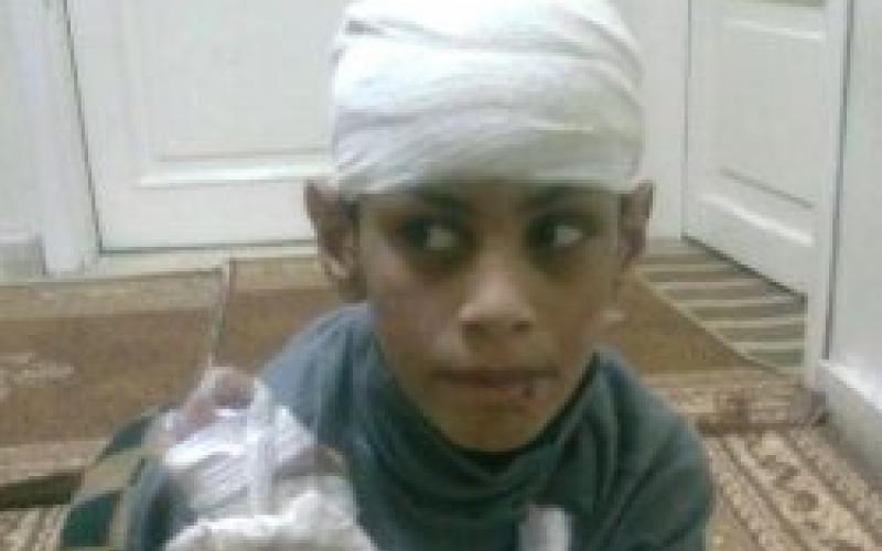 عزايزة لـراديو البلد: سحب ممثلي الوزارة من لجنة التحقيق لضمان الحيادية وللتحقيق مع كافة الأطراف