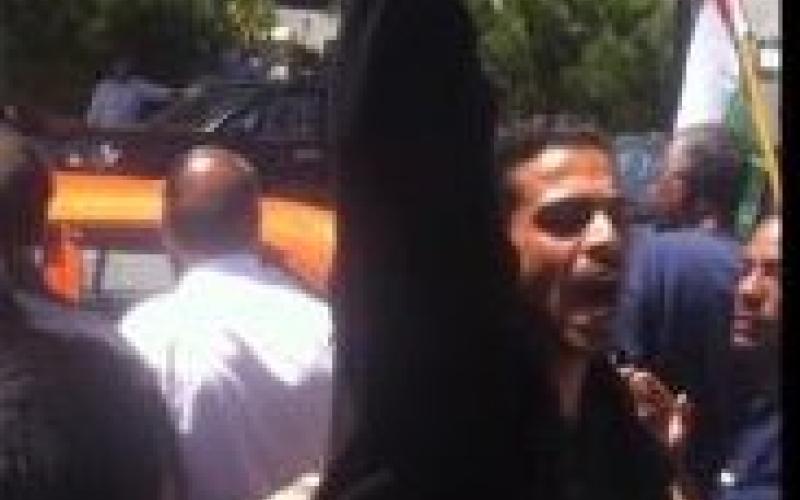 عائلة مصعب لم تتوقع إحراقه لجسده.. وتوجه لمقاضاة الشركة