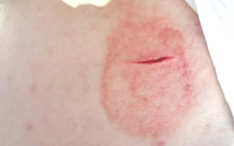 الاعتداء على مسيرتي جرش والمفرق عمل خسيس 