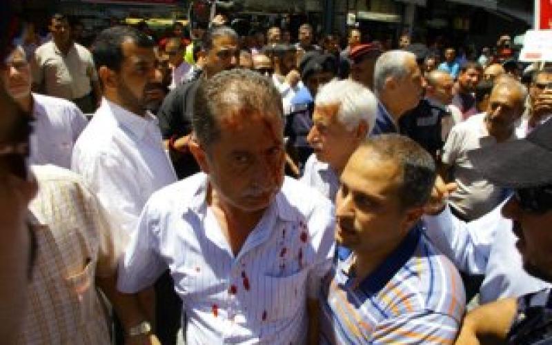  الوطنية للإصلاح لماذا تعجز الحكومة عن حماية الحراك ؟