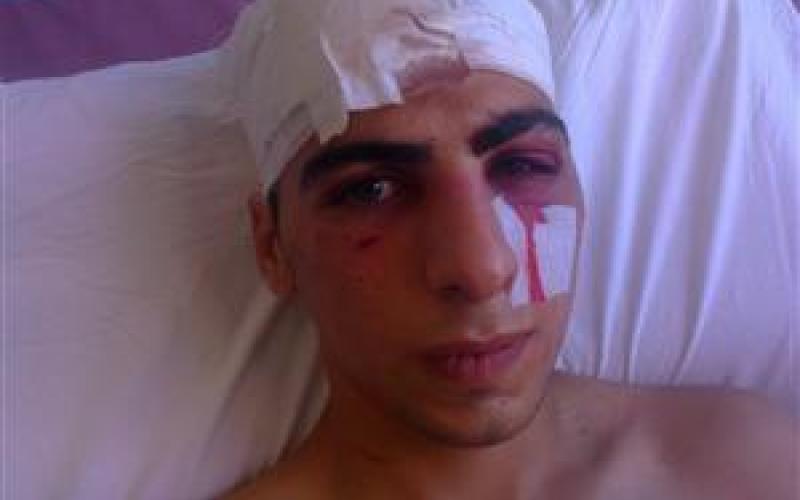 الوطني لحقوق الانسان يطالب بمحاسبة المعتدي على القلالوه