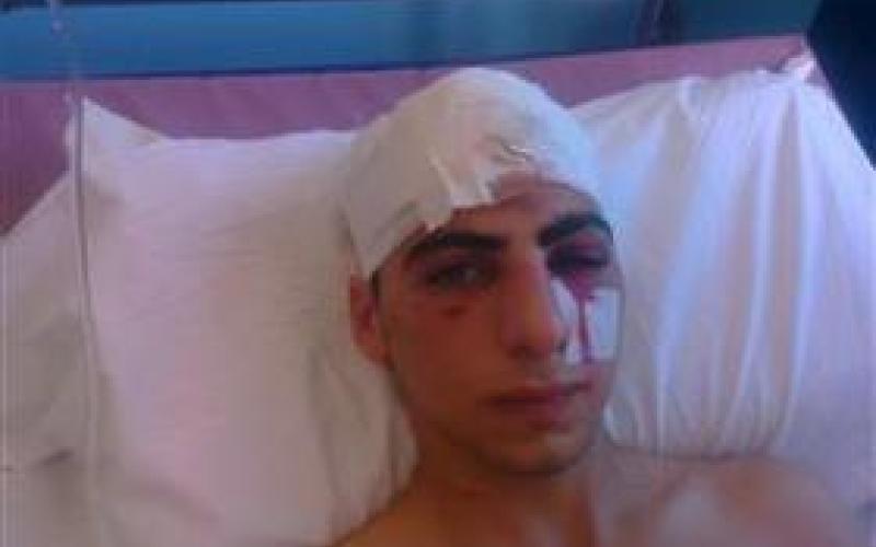 مناهضة التعذيب وعدالة يستنكران الاعتداء على القلالوة