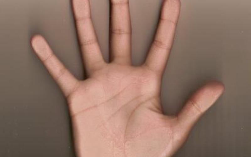 إصابة عامل وافد ببتر في الأصابع