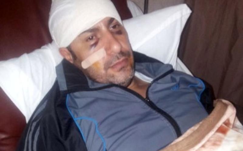 الصحافة الالكترونية تستنكر الاعتداء على الزميل عورتاني